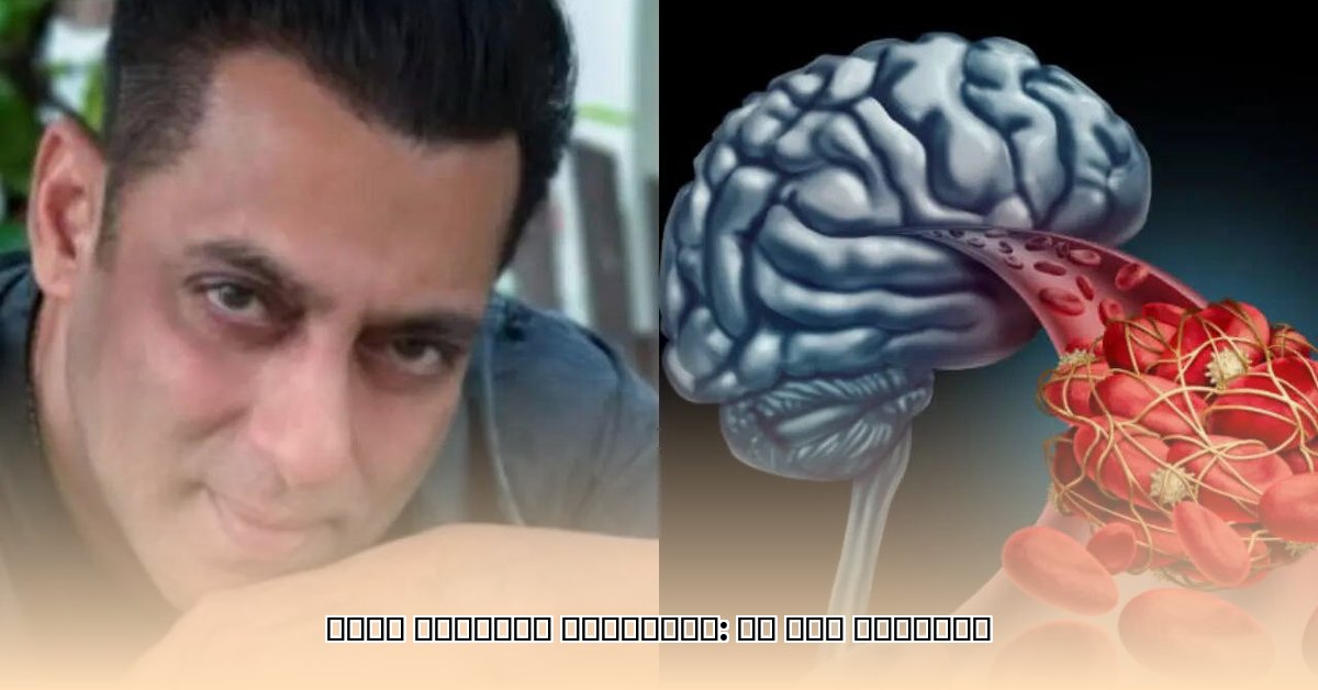 brain-aneurysm